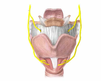 Carcinoma squamocellulare corda vocale destra